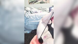 Monia 1990 Dilatazione mostruosa dell'ano