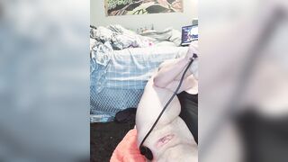 Monia 1990 Dilatazione mostruosa dell'ano