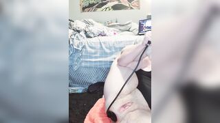 Monia 1990 Dilatazione mostruosa dell'ano