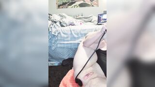 Monia 1990 Dilatazione mostruosa dell'ano