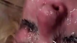 Abuso facciale estremo