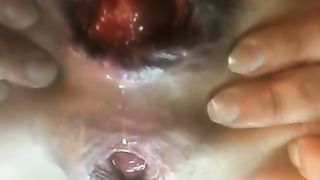 Piccoli prolassi anali compilation