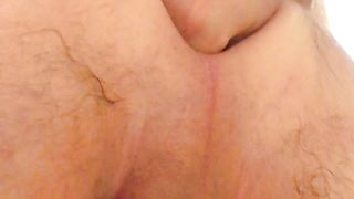 Anal con pino silvestre