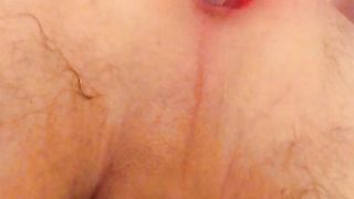 Anal con pino silvestre