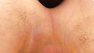 Anal con pino silvestre