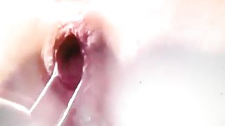 Fisting anale con rosa finale