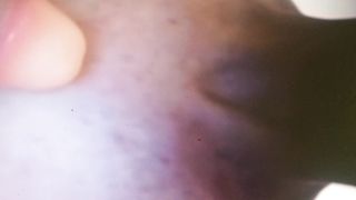 La dottoressa nel cesso