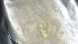 Esamino il mio sperma a Modena