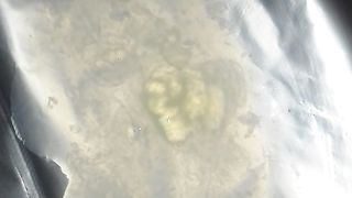 Esamino il mio sperma a Modena