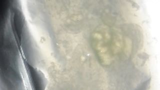 Esamino il mio sperma a Modena