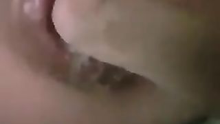 Primo piano di una fistata dal solito master