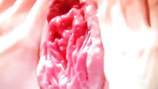 Primi piani dopo una fistata