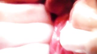 Primi piani dopo una fistata