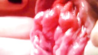 Primi piani dopo una fistata