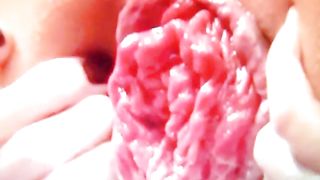 Primi piani dopo una fistata