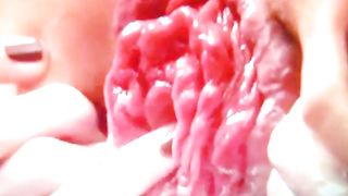 Primi piani dopo una fistata