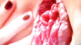 Primi piani dopo una fistata