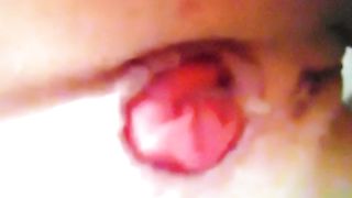 Un ano aperto in primo piano