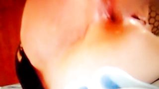 Dilatazione con dildi...