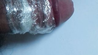 Cazzone impacchettato da infermiera a Mantova