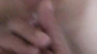 altro prolassetto anale...