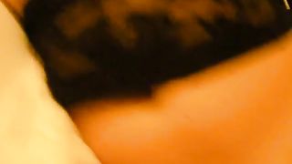 altro prolassetto anale...