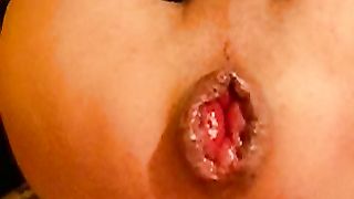 culo aperto al naturale...