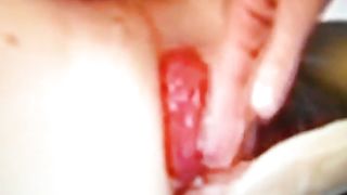 fisting con prolasso...