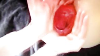 fisting con prolasso...