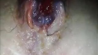 un ano veramente slabbrato dall'uso...