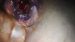 un ano veramente slabbrato dall'uso...