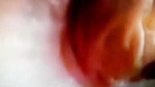 prolassetto con cacchina...