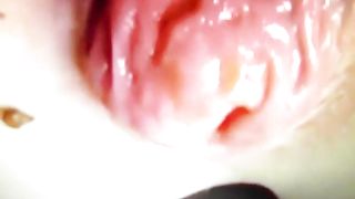 prolassetto con cacchina...