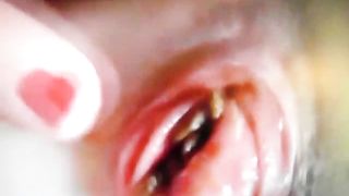 prolassetto con cacchina...