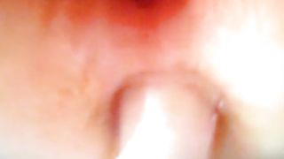 un culetto pelosetto...