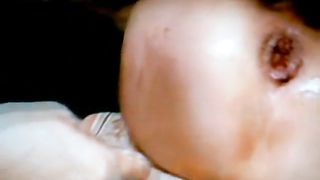 Un esperto fistatore....