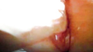 Sculacciate, dilatazioni e fisting