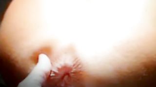 Sculacciate, dilatazioni e fisting