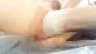 Fisting con prolasso iniziale