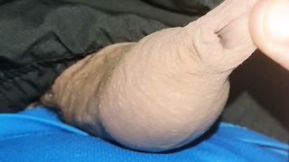 Anteprima del video: Pisello con fimosi