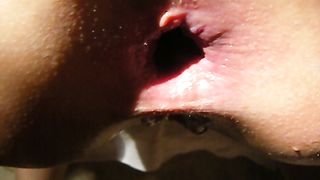 Culo aperto e prolassato...