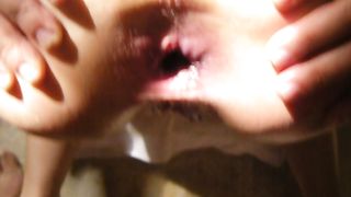 Culo aperto e prolassato...