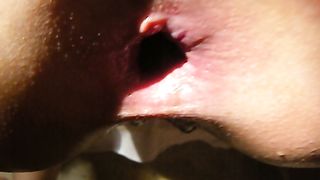 Culo aperto e prolassato...