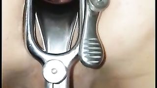 Dilatato con le palle legate