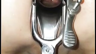 Dilatato con le palle legate