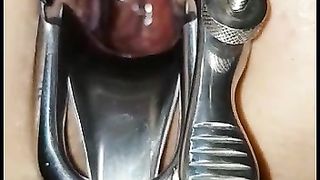 Dilatato con le palle legate