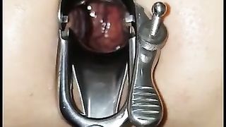 Dilatato con le palle legate