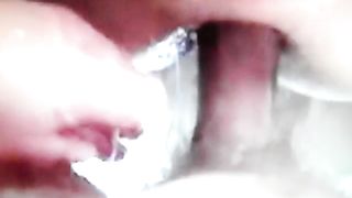 Trav scopata nel prolasso  anale