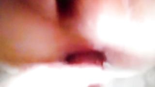 Trav scopata nel prolasso  anale