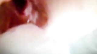 Trav scopata nel prolasso  anale